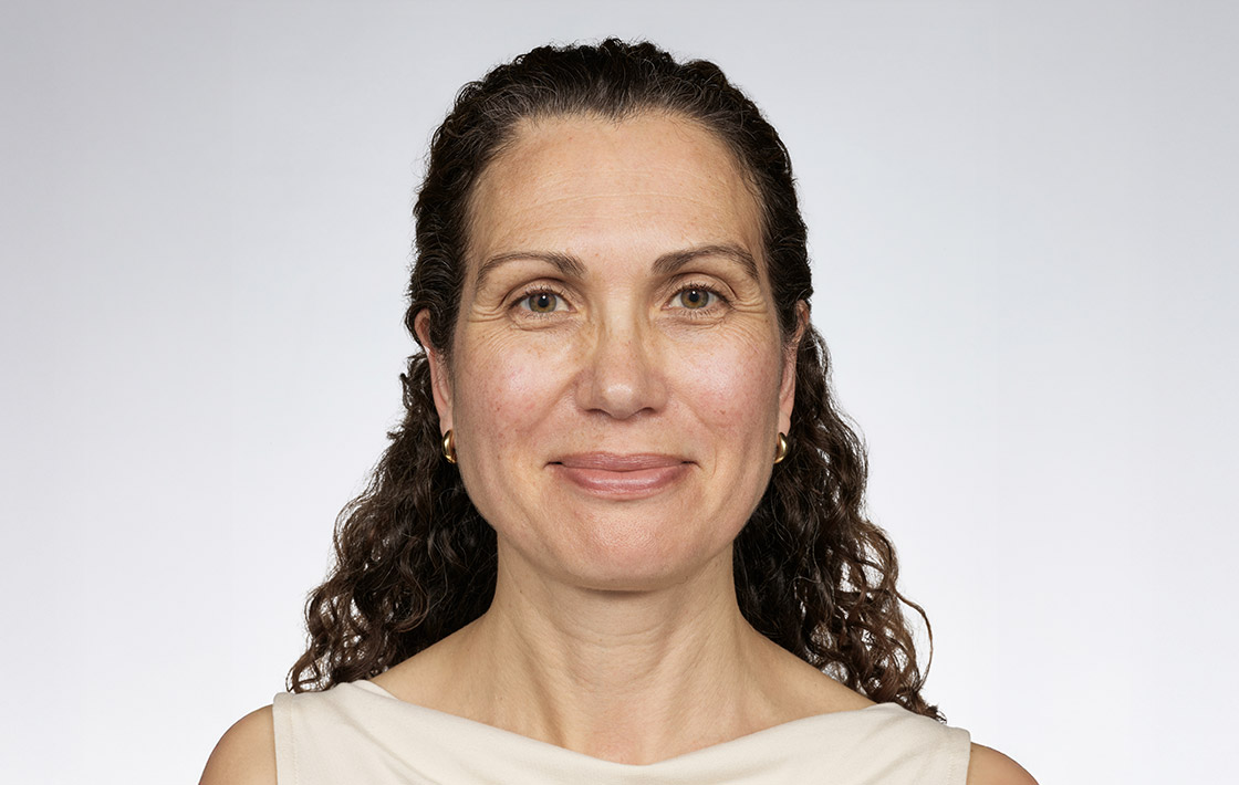 A person before using Future Renew Night Serum for eight weeks